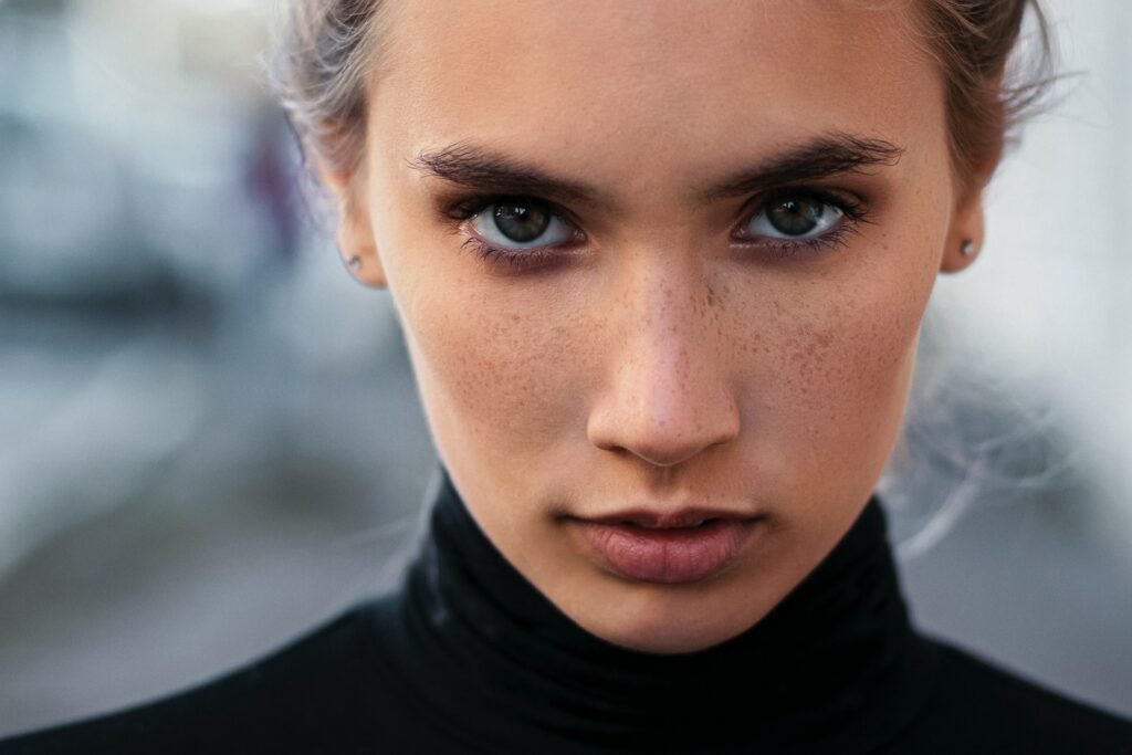 acne